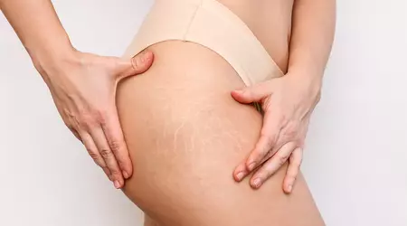 Эстетические и косметические проблемы